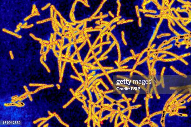 Legionella Pneumophila, The Bacteria Responsible For Legionellosis Or Legionaire's Disease. Symptoms Include Pneumonia, Flu Like Symptoms,...