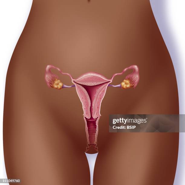 Female Reproductive Organs. Anterior View Of The Female Reproductive Organs Dark Skin:From Bottom To Top Vagina Uterus Fallopial Tubes Ovaries Yellow.