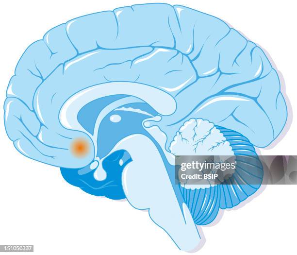 Brain And Localization Of The Accumbens Nucleus In Orange.