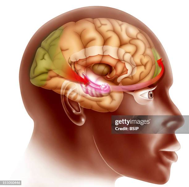 Love At First Sight Stage 2 See Image No. 11895 05 For Stage 1 And No. 11897 05 For Stage 3. Illustration Of What Occurs In The Brain When A Subject...