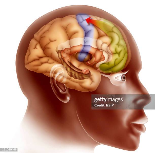 Love At First Sight Stage 3 See Image No. 11895 05 For Stage 1 And No. 11896 05 For Stage 2. Illustration Of What Occurs In The Brain When A Subject...