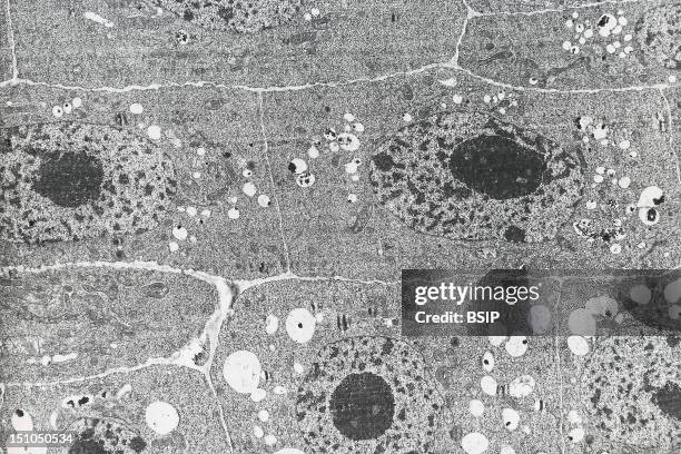Meristem Of An Onion Root Composed Of Undifferentiated Embryonic Cells. Mitosis Cell Division Is Active In The Meristem Allowing The Root To...