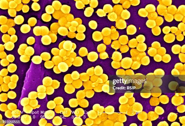 Methicillin Resistant Golden Staph Staphylococcus Aureus Mrsa, Scanning Electron Micrograph Colorized Sem, X 9560, The Line Represents Two Microns....