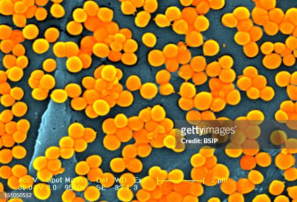 Methicillin Resistant Golden Staph Staphylococcus Aureus Mrsa, Scanning Electron Micrograph Colorized Sem, X 9560, The Line Represents Two Microns....