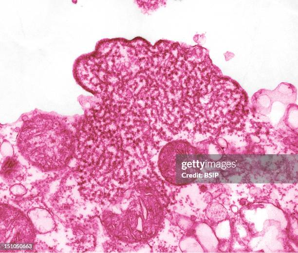 Virus Nipah In The Cerebrospinal Fluid Of An Infected Patient Tem, Recolorized Imagery. Nipah Virus Is A Rna Virus From The Paramyxoviridae Family...
