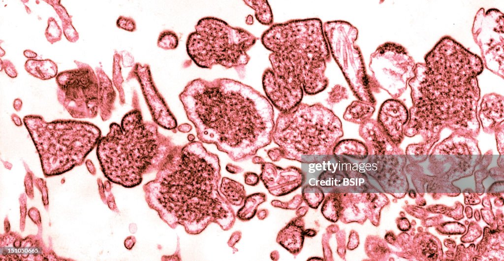 Nipah Virus