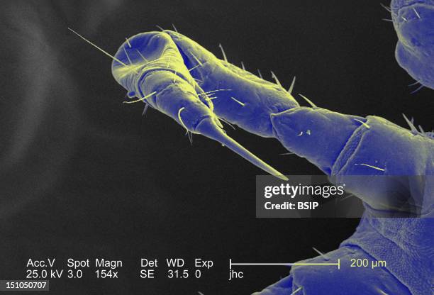 Anterior Right Paw Of A Female Body Louse Pediculus Humanus Corporis, Colorized Sem Dorsal View ; X 154, The Line Represents 200 Microns. The Paw Of...