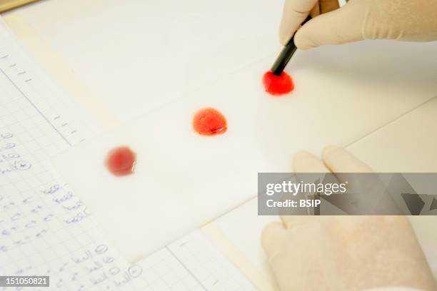 Photo Essay From Laboratory. Determination Of Blood Group Abo On Plate. Research Of Erythrocyte Antigens Abo Grouping. Here, Mix Of Each Drop Of The...