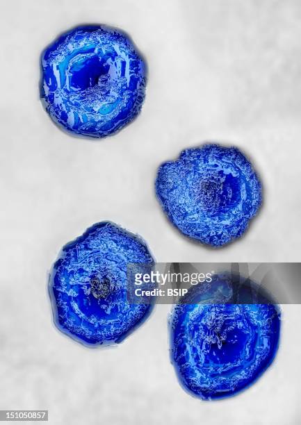 Herpes Simplex Virus Type 2 Hsv2. Image Hdri Made According To A View Under Transmission Electron Microscope, Viral Diameter 180Nm. This Virus Is...