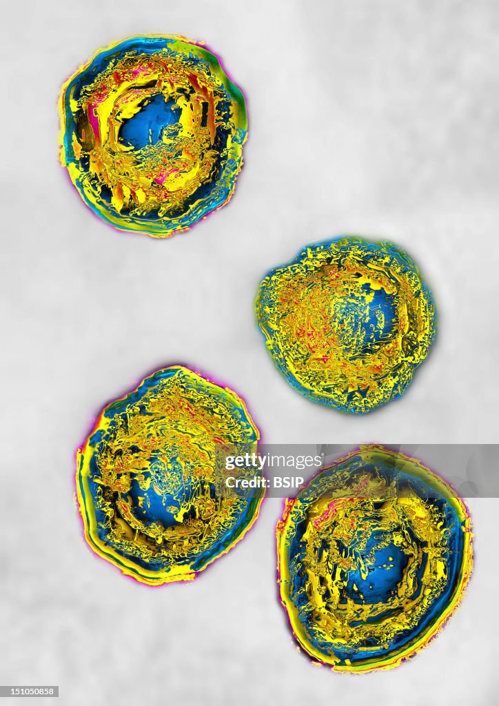 Herpes Simplex Virus Type 2 Hsv2. Image Hdri Made According To A View ...
