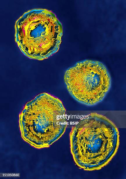 Herpes Simplex Virus Type 2 Hsv2. Image Hdri Made According To A View Under Transmission Electron Microscope, Viral Diameter 180Nm. This Virus Is...