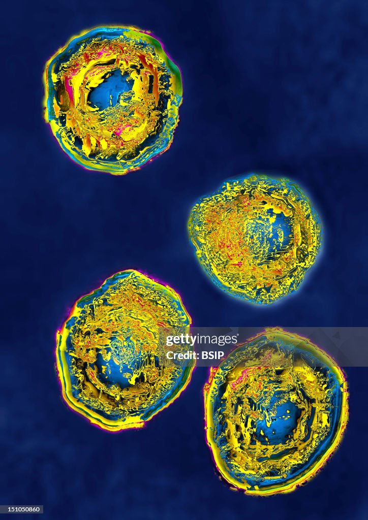 Herpes Simplex Virus Type 2 Hsv2. Image Hdri Made According To A View ...