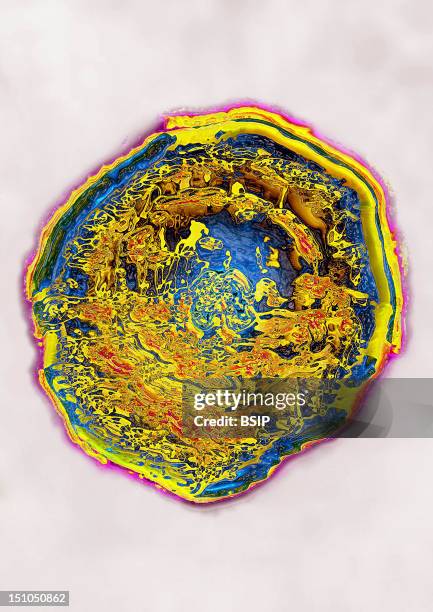 Herpes Simplex Virus Type 2 Hsv2. Image Hdri Made According To A View Under Transmission Electron Microscope, Viral Diameter 180Nm. This Virus Is...