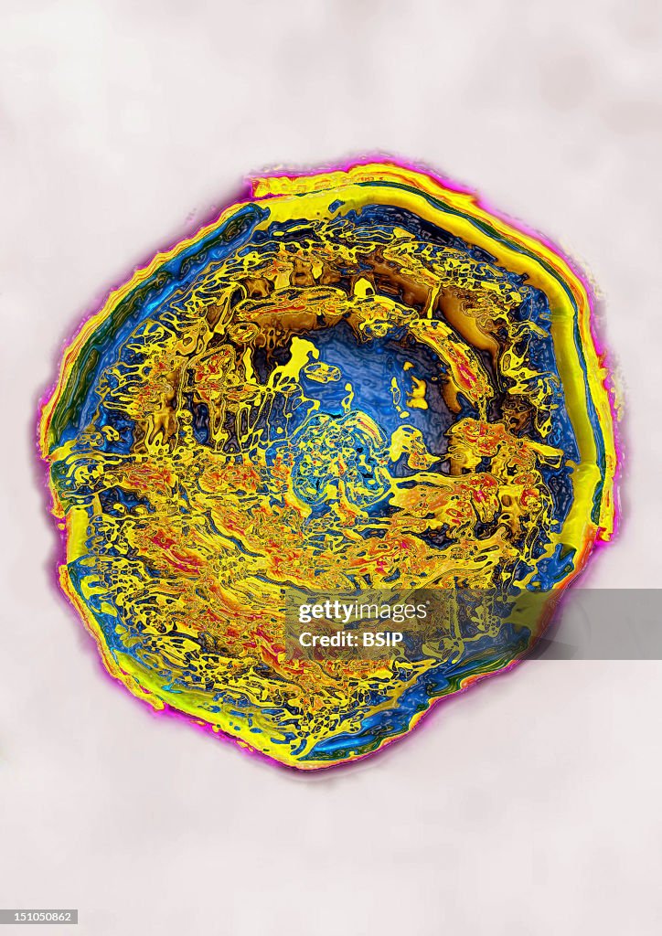 Herpes Simplex Virus Type 2 Hsv2. Image Hdri Made According To A View ...