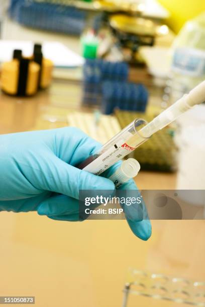 Photo Essay At The Hospital Of Meaux 77, France. Laboratory Of Biochemistry. Preparation Of The Blood And Urine Samples That Will Be Analyzed By The...