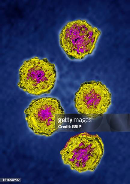 Poliovirus. Human Poliovirus Is The Agent Responsible For Poliomyelitis. Single Stranded Rna Virus. Image Hdri Made According To A View Under...