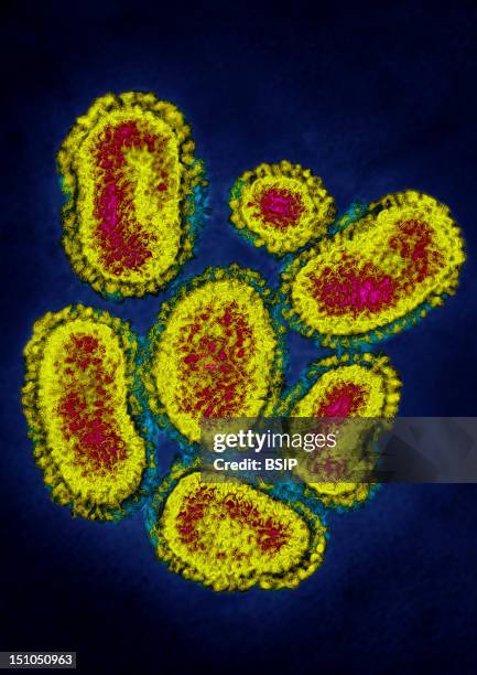 Myxovirus Influenza A H1N1. Swine Influenza Visualized By Hdri Image Treatment, On A View Under Transmission Electron Microscope. Viral Diameter Of...