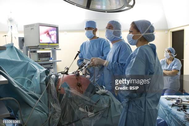 Photo Essay At The Hospital Of Meaux 77, France. Visceral And Digestive Surgery. Surgery Of Obesity Sleeve Gastrectomy Under Laparoscopy.