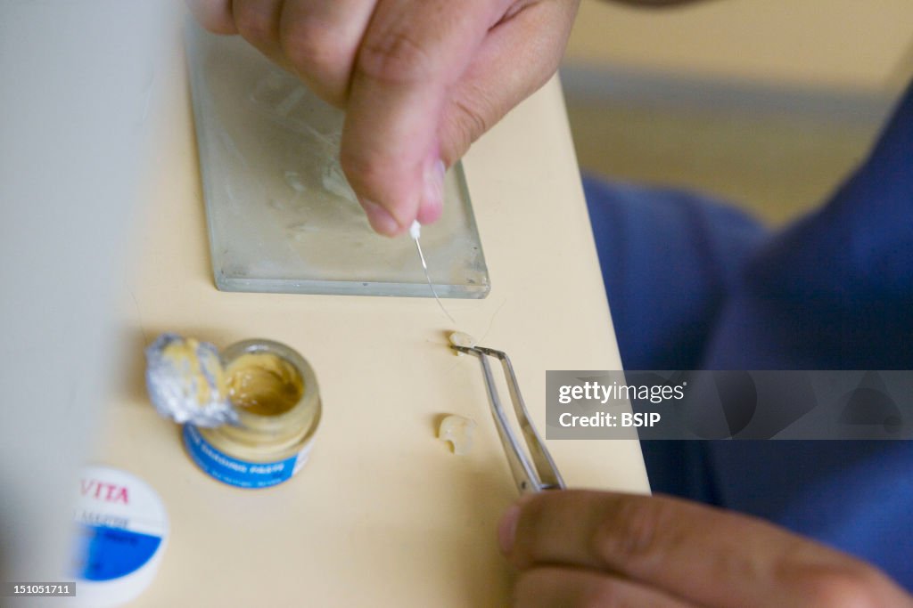 Making Dental Prosthesis