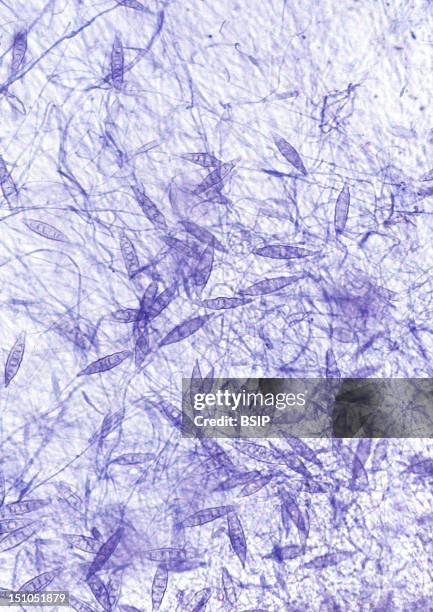 Ringworm Microscope Fotografías e imágenes de stock - Getty Images