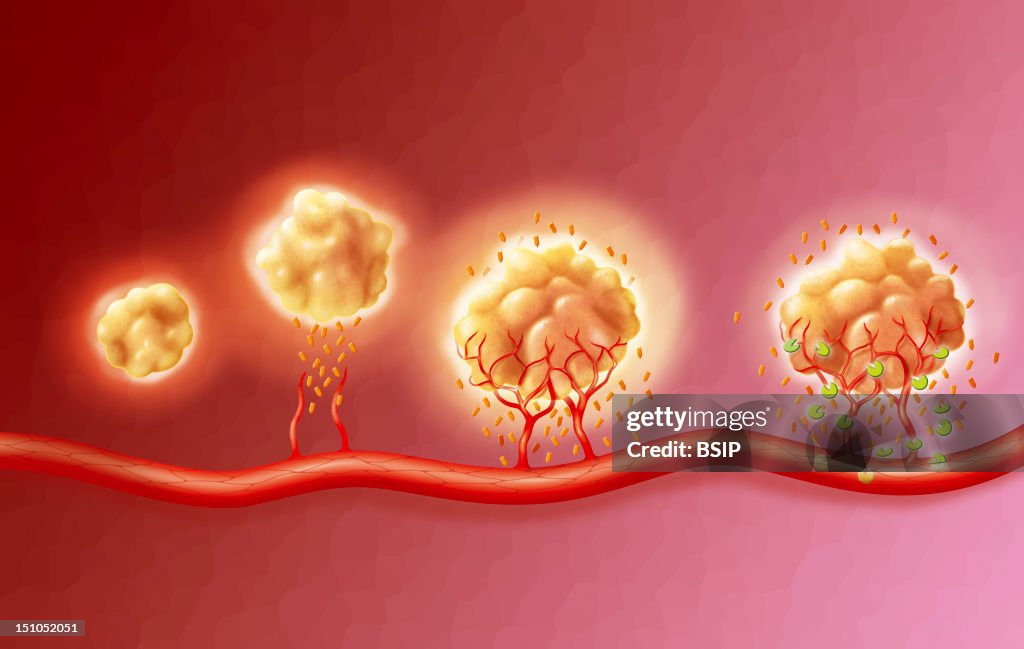 Anti-Angiogenesis