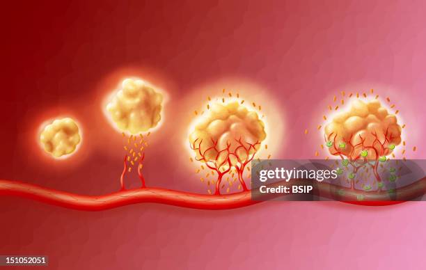 Angiogenesis Infection 70 Angiogenesis Stock Photos, High-Res Pictures, and Images - Getty Images