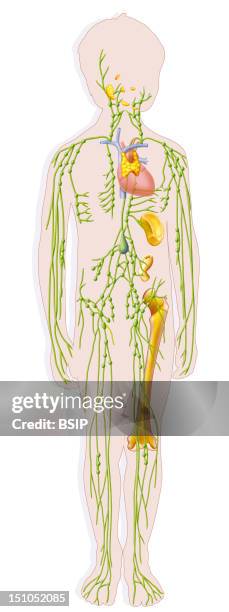 The Lymphatic System In A 10 Year Old Child. Are Represented The Vessels And The Lymphatic Ganglions, The Pharyngeal Tonsils Named Adenoid...