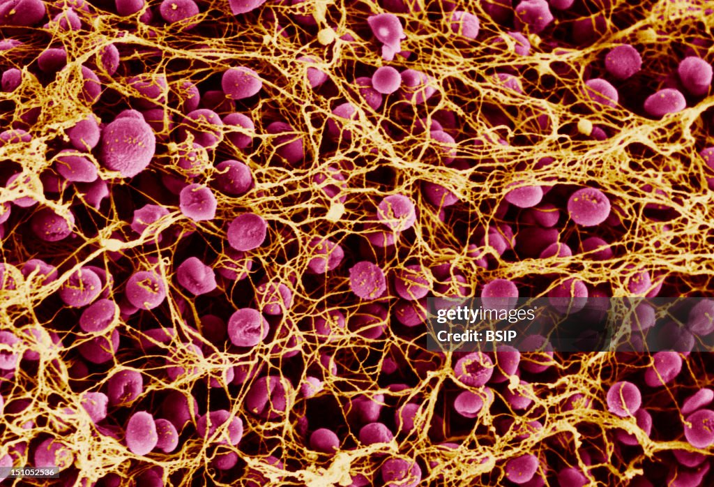 Red Blood Cell & Fibrin, Sem
