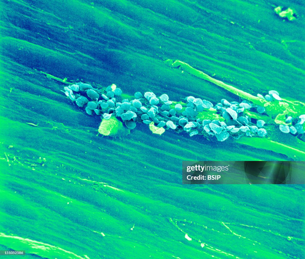 Rabbit Platelet, Sem