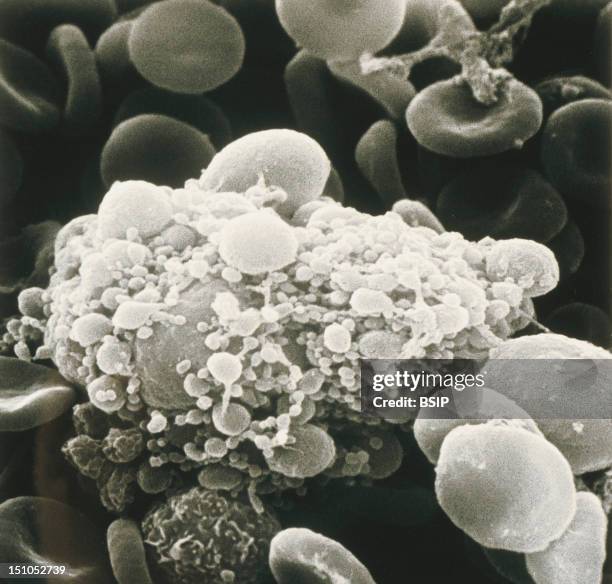 Megacaryocyte Photos and Premium High Res Pictures Getty Images
