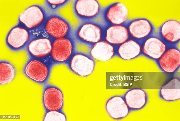 Cowpox Virus Virions, Used In The Preparation Of The Smallpox Vaccine.