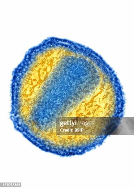 17 Microscope View Of Hiv Stock Photos, High-Res Pictures, and Images ...