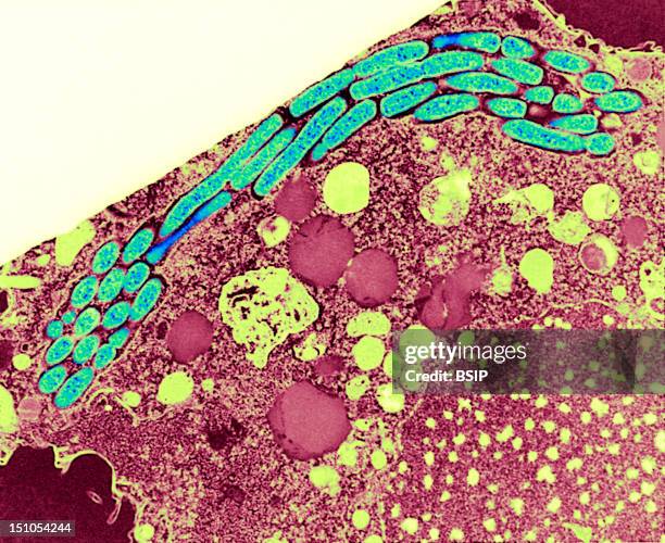 Protozoa Tetrahymena Pyriformis Infected With Legionella Pneumophila. This Transmission Electron Micrograph Tem Of An Infected Tetrahymena Pyriformis...