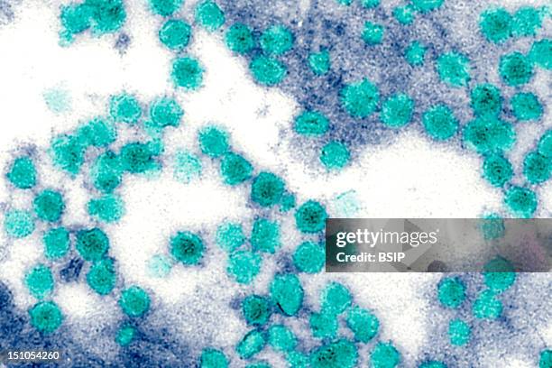 The West Nile Virus Is Transmitted To Humans Through The Bite Of An Infected Mosquito. An Electron Micrograph Of The West Nile Virus. West Nile Virus...