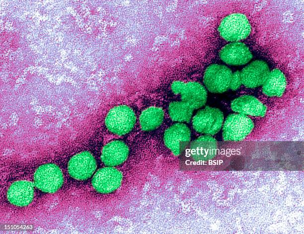 The West Nile Virus Is Transmitted To Humans Through The Bite Of An Infected Mosquito. An Electron Micrograph Of The West Nile Virus. West Nile Virus...