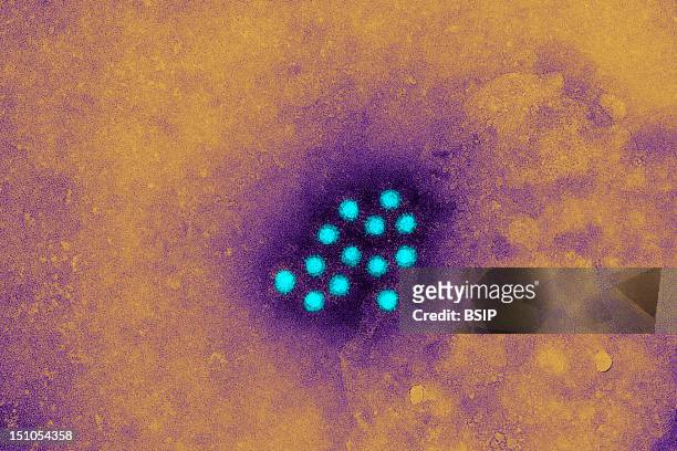 An Electron Micrograph Of The Hepatitis A Virus Hav, An Rna Virus That Can Survive Up To A Month At Room Temperature. This Virus Enters An Organism...