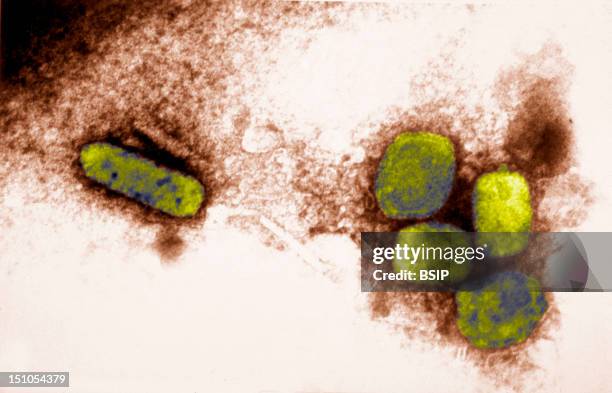 Smallpox Microscope Photos and Premium High Res Pictures - Getty Images