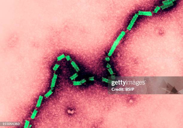 This Electron Micrograph Depicts The Paramyxovirus 4A Nucleocapsid With Its Herringbone Shaped Rna Core. Being That The Parainfluenza Viruses Are...