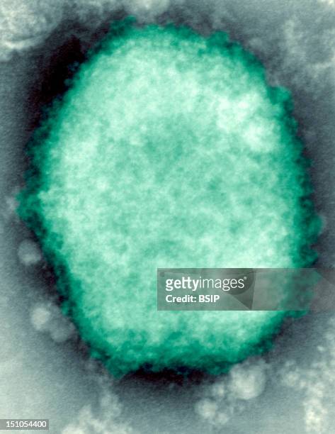 Monkeypox Virus Present In Human Vesicular Fluid.