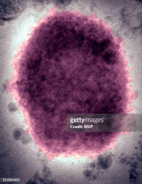 Monkeypox Virus Present In Human Vesicular Fluid. Here A Negative Stain Electron Micrograph Reveals A "M" Mulberry Type Monkeypox Virus Virion In...
