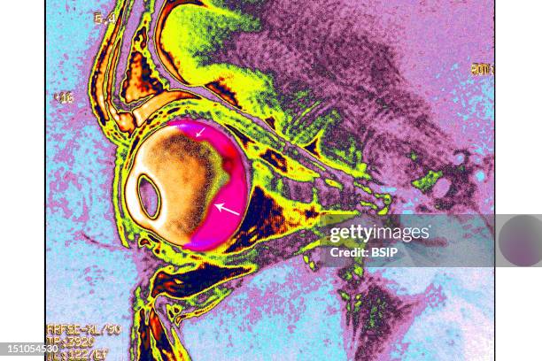 Retinal Scanner Photos and Premium High Res Pictures - Getty Images