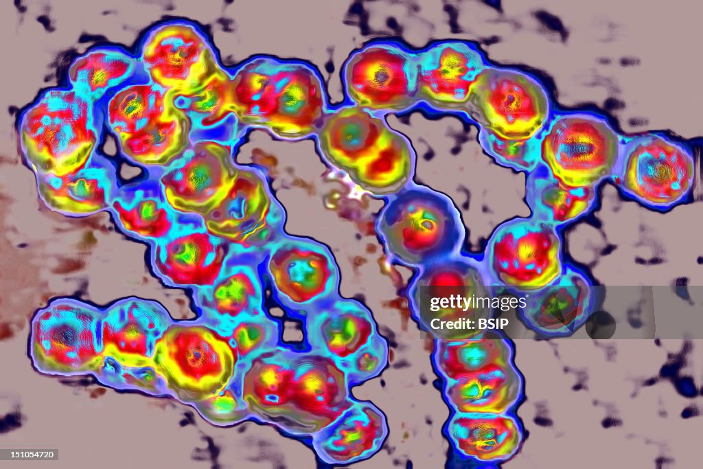 Streptococcus