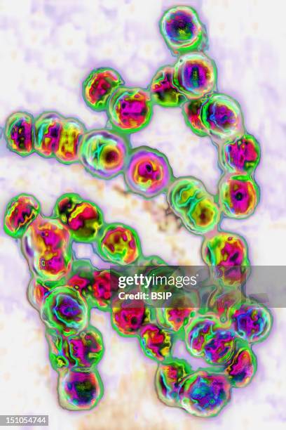 Streptococcus Round Shaped Bacteria Gram Positive Cocci, Which Group Characteristically In Chains Resembling A String Of Pearls. The Bacteria Is...