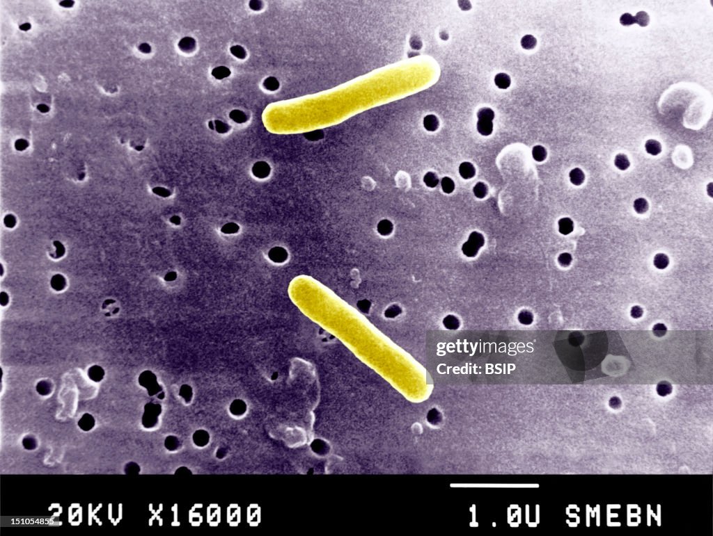 Salmonella Typhimurium
