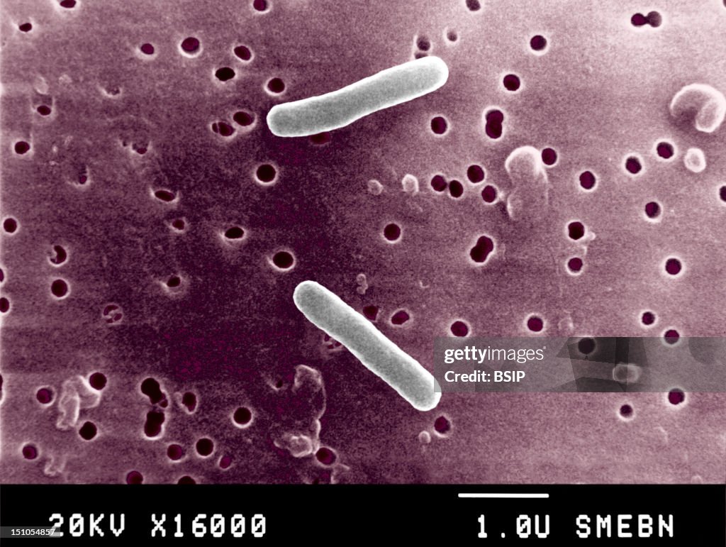 Salmonella Typhimurium