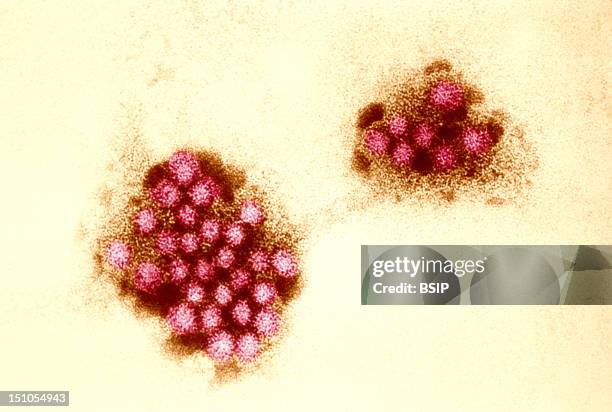 An Electron Micrograph Of The Norwalk Virus, With 27 32Nm Sized Viral Particles. Norwalk Viruses And Related Caliciviruses Are Important Causes Of...