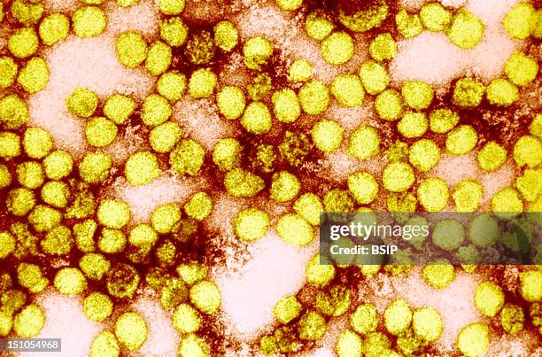 An Electron Micrograph Of Yellow Fever Virus Virions. Virions Are Spheroidal, Uniform In Shape And Are 40 60Nm In Diameter. The Name "Yellow Fever"...