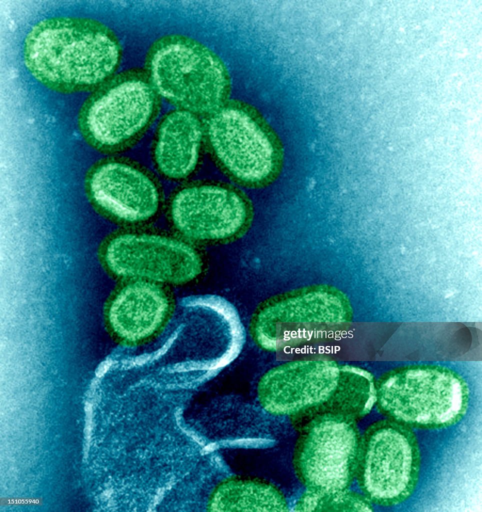 Spanish Flu Infection