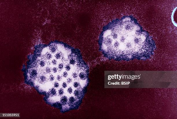 An Electron Micrograph Of The Norovirus, With 27 32Nm Sized Viral Particles. Norwalk Viruses And Related Caliciviruses Are Important Causes Of...