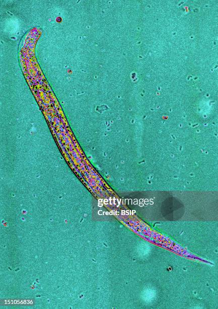 Anguillula, An Intestinal Parasite Which Is The Causative Agent Of Strongyliasis. Microscopic Image 400X.